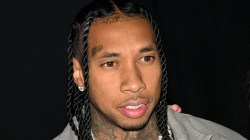 Tyga Put Under General Anesthetic For Massive Back Tattoo